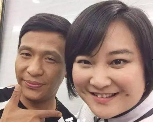 贾玲爆料瘦脸针视频,揭秘明星美容秘密